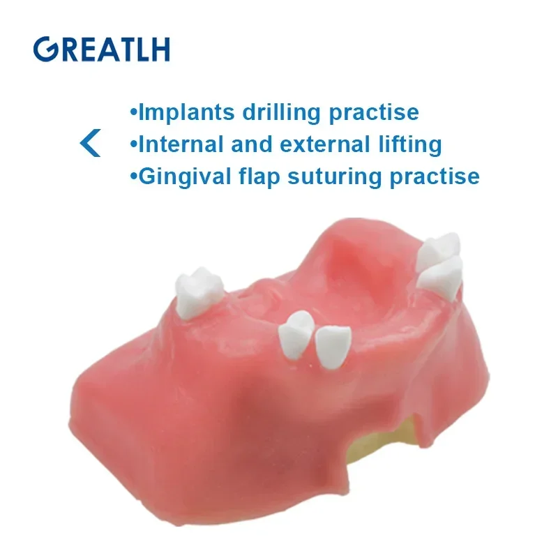 Dental Maxillary Sinus Teeth Model Dental Implant Teaching Model Dentist Demonstration Model Dental Materials