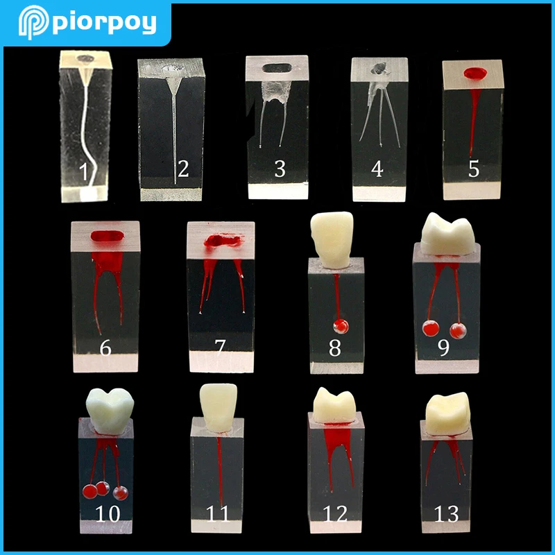 Modelo de enseñanza de bloques de Canal de raíz Dental, entrenamiento de endodoncia, modelo de dientes, práctica RCT, cavidad de pulpa, resina,