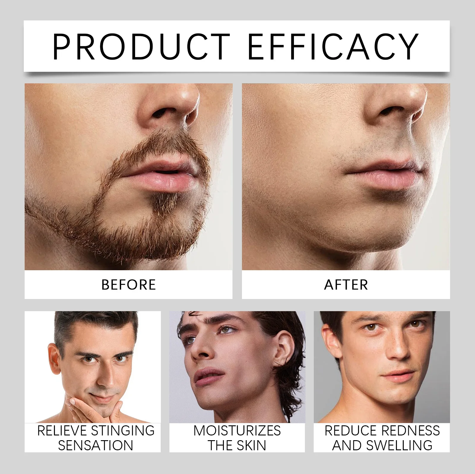 Deep Moisturizing Aftershave Spray Soothes Beard Irritation Reduces Redness Swelling Intense Hydration Reduces Redness Swelling