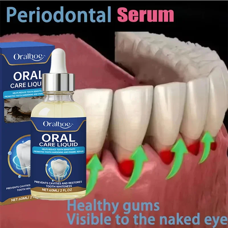Suero de Gel para el cuidado de las encías dañadas, 60ML, alivia las encías dolorosas, alergias, limpieza profunda, manchas de dientes, sarro, suero, pasta de dientes para caries dentales