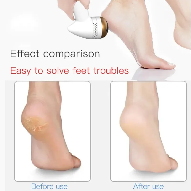 เครื่องมือดูแลเท้าแบบมืออาชีพที่ขัดกำจัดหนังด้านและเท้าด้วยไฟฟ้า
