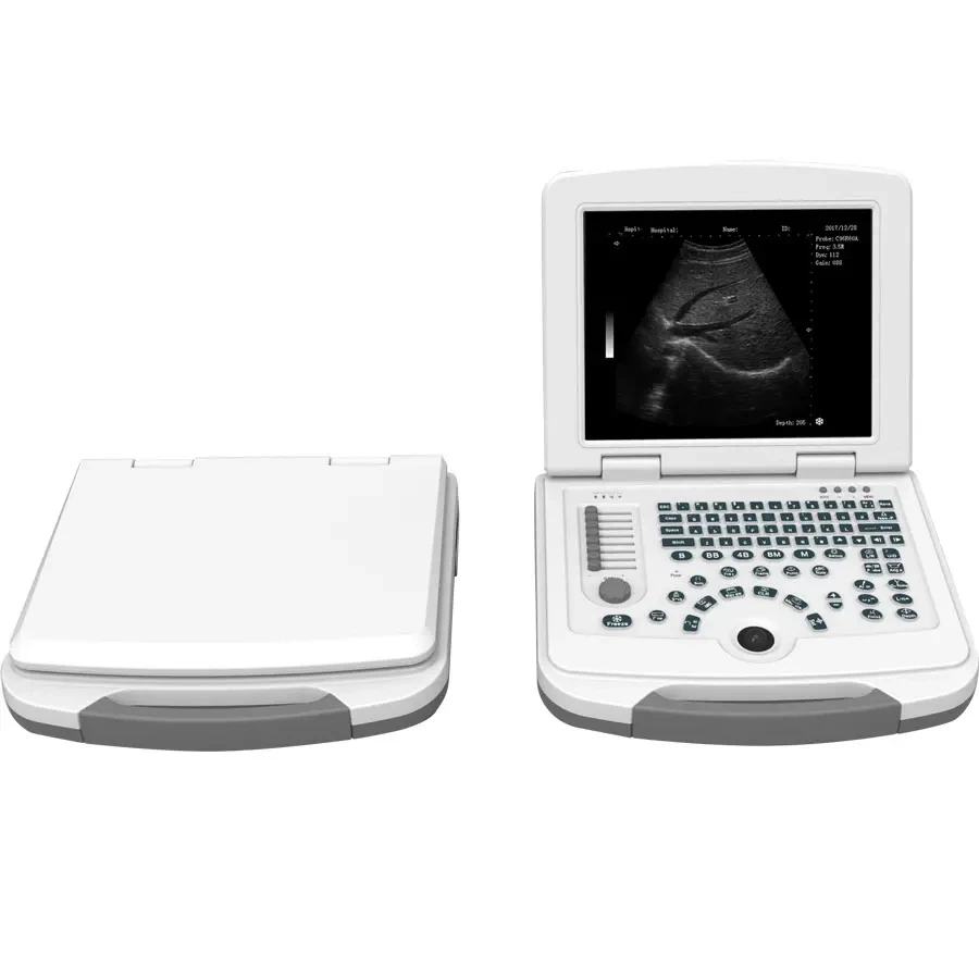 

96 Elements 12 Inch LED Laptop Portable B Ultrasound Scanner Echo Machine Echograph Laptop Ultrasound System