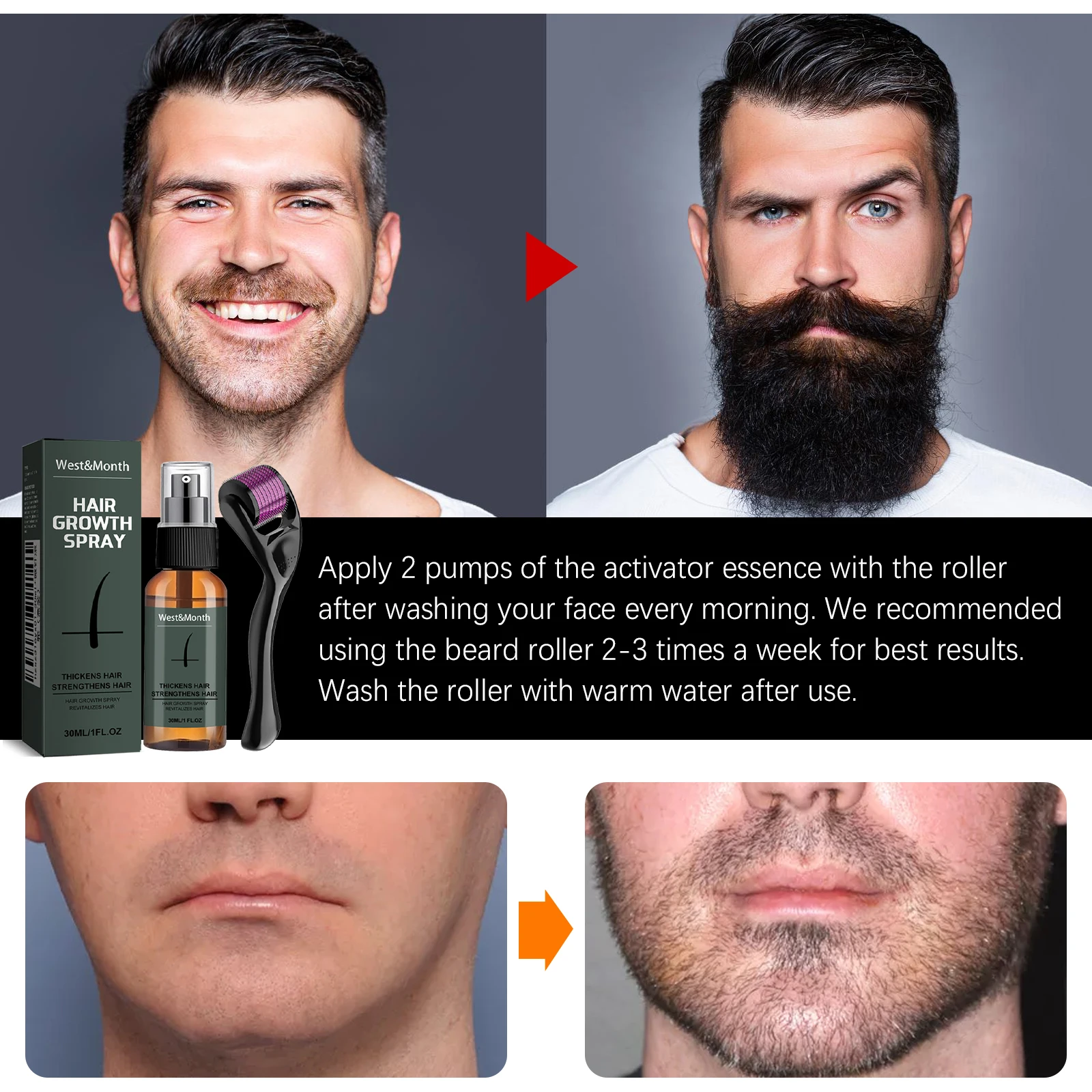 Men's Beard Spray Kit with Micro Roller 0.25mm Moisturizing Thicken Facial Hair Beard Boosting Essence Nourishing Spray Bear - view 5