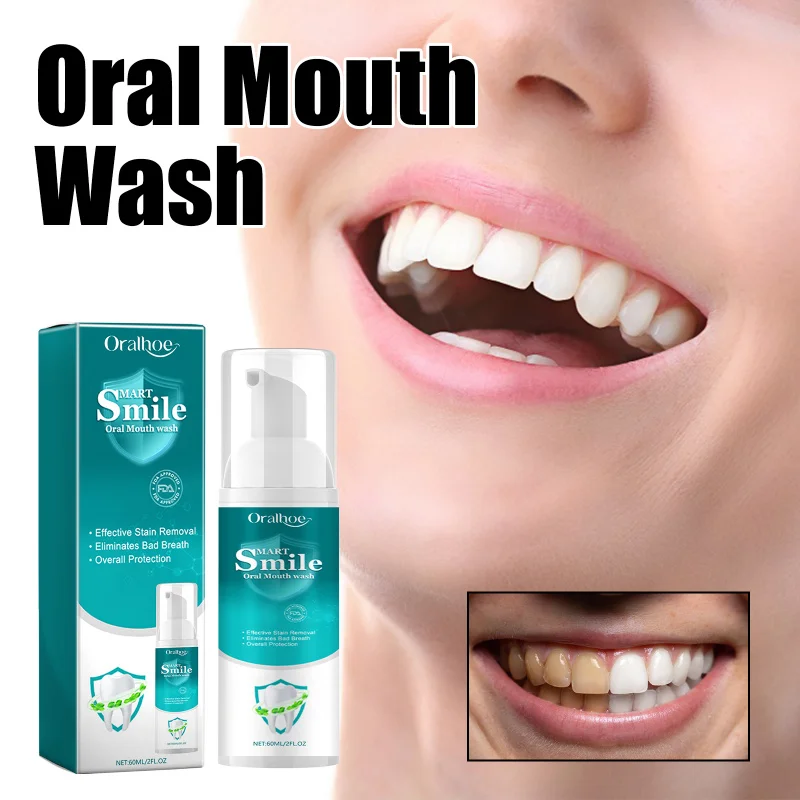 

Oral Teeth Whitening Mousse - Dental Cleaning, Yellow Stain Removal, Enamel Repair & Fresh Breath With Natural Extracts