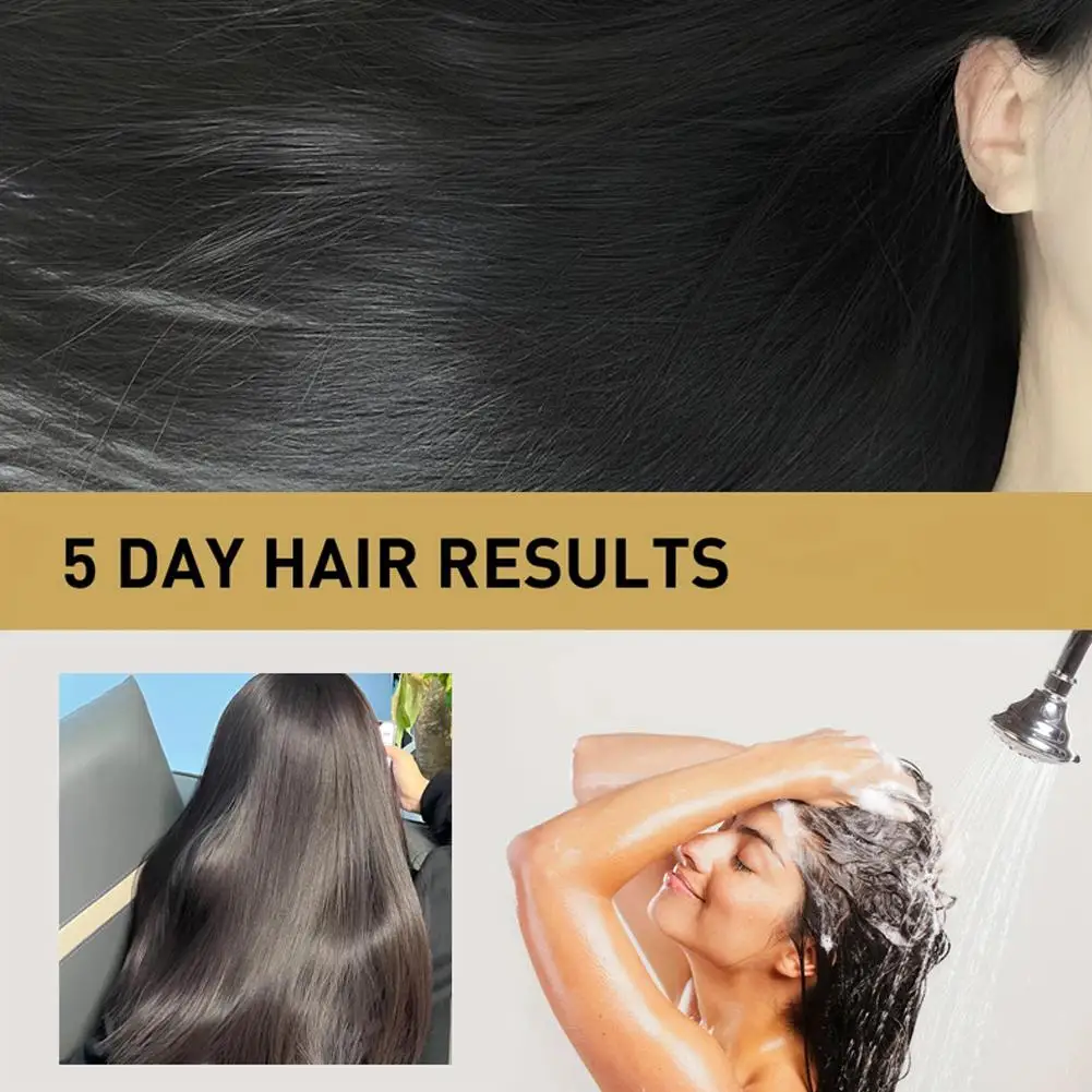 مجموعة شامبو بلسم الشعر بالزنجبيل، متعددة الوظائف، ملحقات الشعر التالفة، العناية بفروة الرأس، مغذية للشعر، تمنع الإصلاح