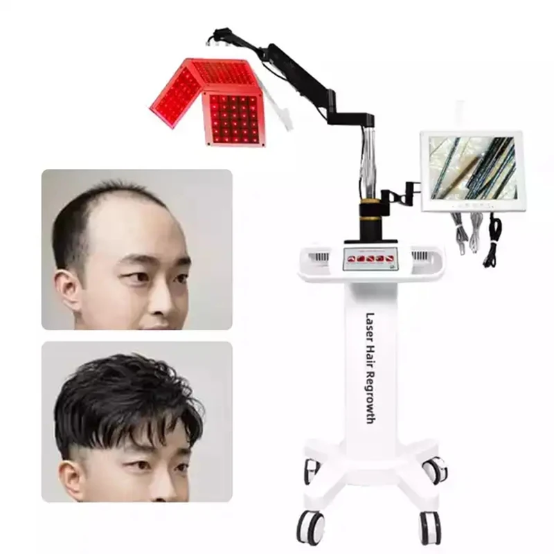 

Hair Regrowth Machine Red Light Therapy Anti-hair Loss Treatment 5 in 1 Diode Laser Hair Growth Hair Follicle Detection Machine