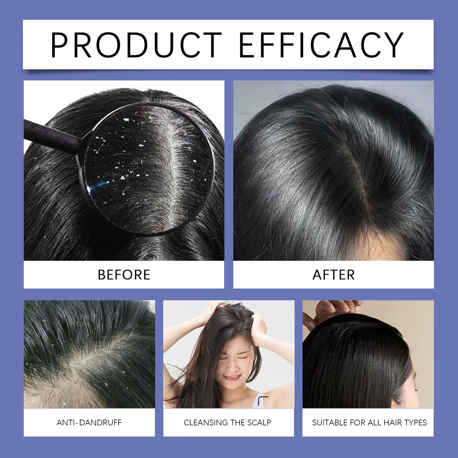 Selenium Sulfide Hair Shampoo Deep Cleansing Scalp Remove Dandruff Refreshing Strengthen Hair Roots Smoothing Soften Shiny Hair view 5