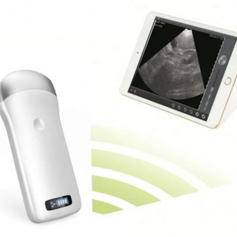 

the smallest ultrasound scanner usb ultrasound linear probe