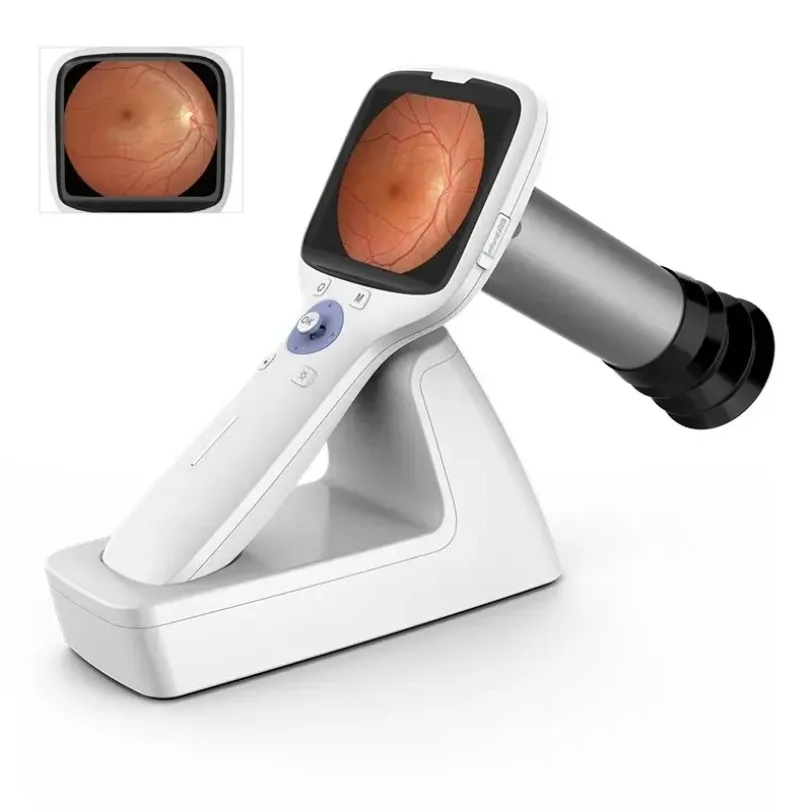 Ophthalmic Handheld Non-Midiatric Fundus Retinal Camera for Eye Exam (THR-1000P)