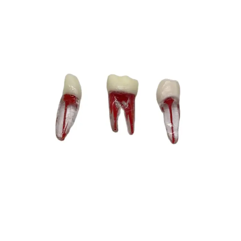 Dental Root Canal Teeth Model M8007 Root Pulp Cavity Model