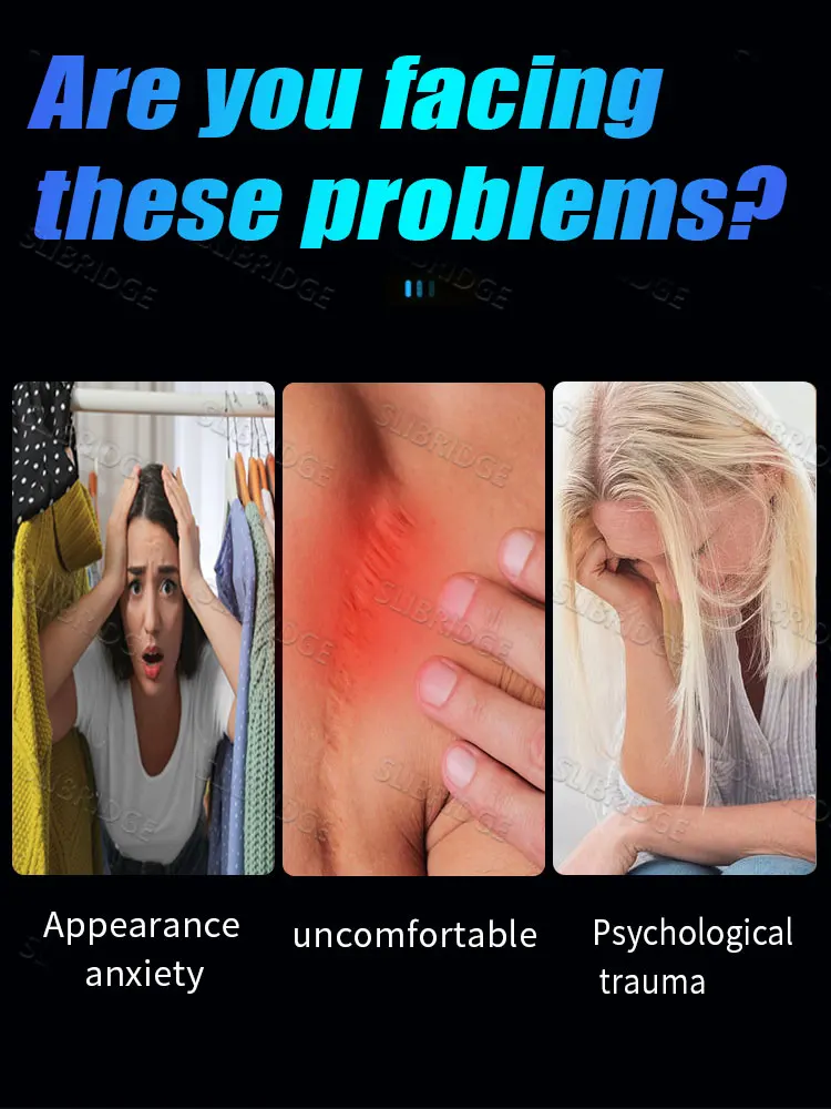 Bolígrafo de luz azul para resolver cicatrices, envío gratis, herramientas para el cuidado de los cicatrices, indoloro, uso doméstico, fácil de usar