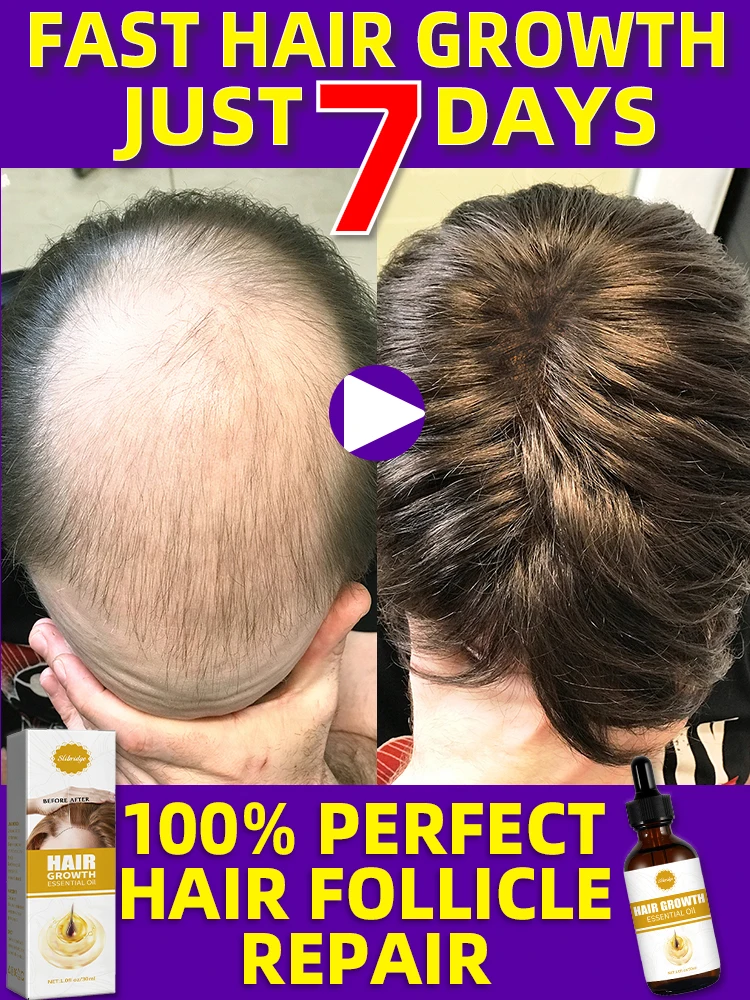 

99% of buyers buy again, have more and more hair, say goodbye to baldness, thick hair,Hot selling product