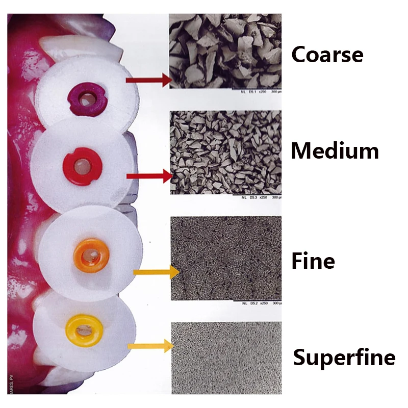 40 Stuks Tandheelkundige Composiet Afwerking En Polijsten Schijven Doorn Strepen Set Orale Doorschijnende Polijstschijven Tandarts Slijpen Gereedschap