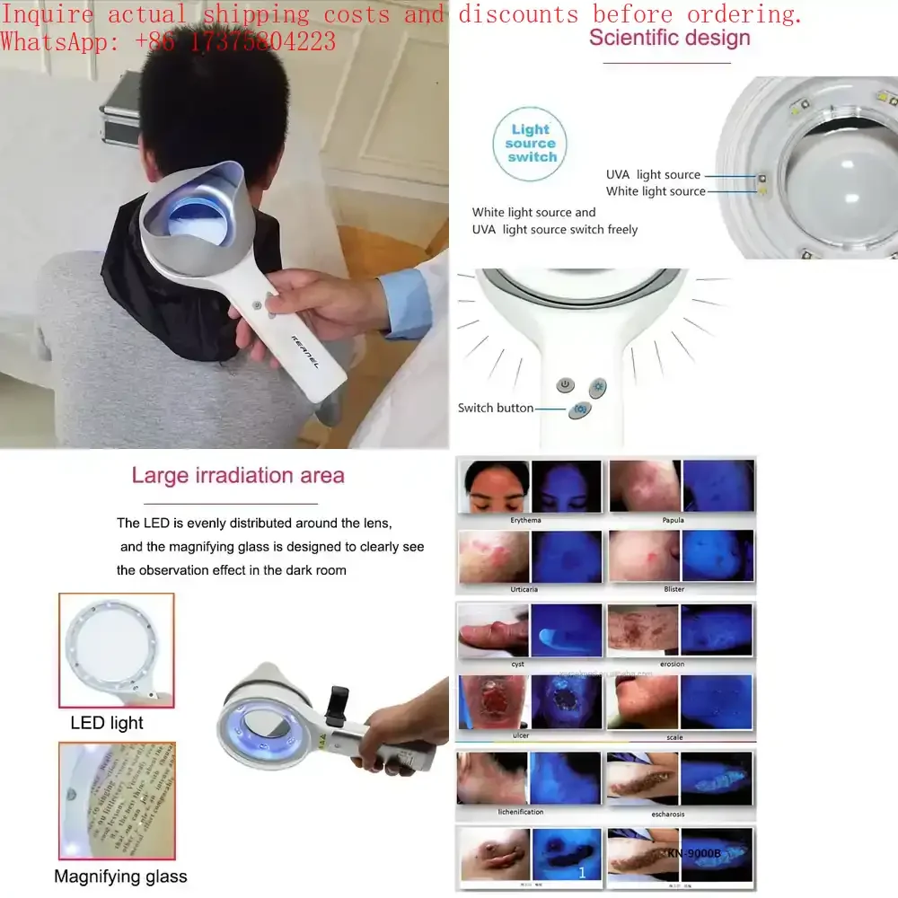 

KN- 9000B Veterinary Medical Woods Lamp test and Diagnosis Magnifier Dermatologic Wood Lamp with UBA &LED Light