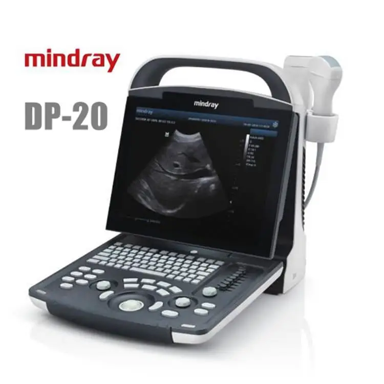 Mindray DP-20 Ultrasound Scanner Price Medical Ultrasound Instruments B/W Portable Ultrasound Machine