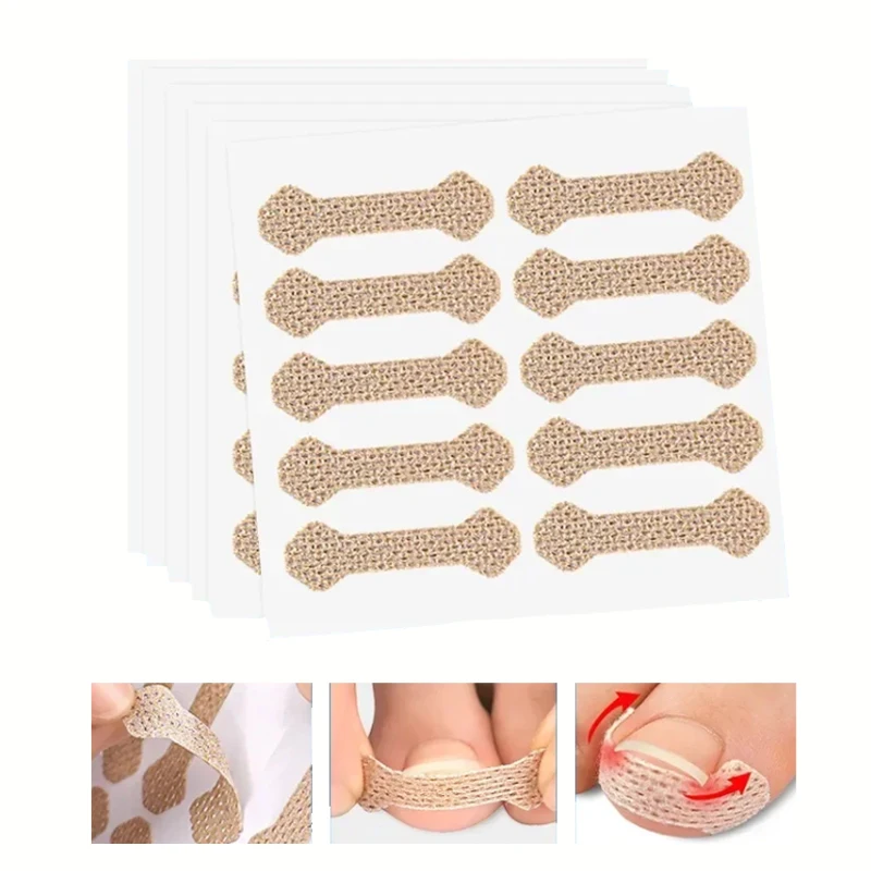 10/30/50 pezzi adesivi per la correzione delle unghie correttore dell'unghia del piede incarnita patch trattamento recuperare correttore pedicure strumento di cura