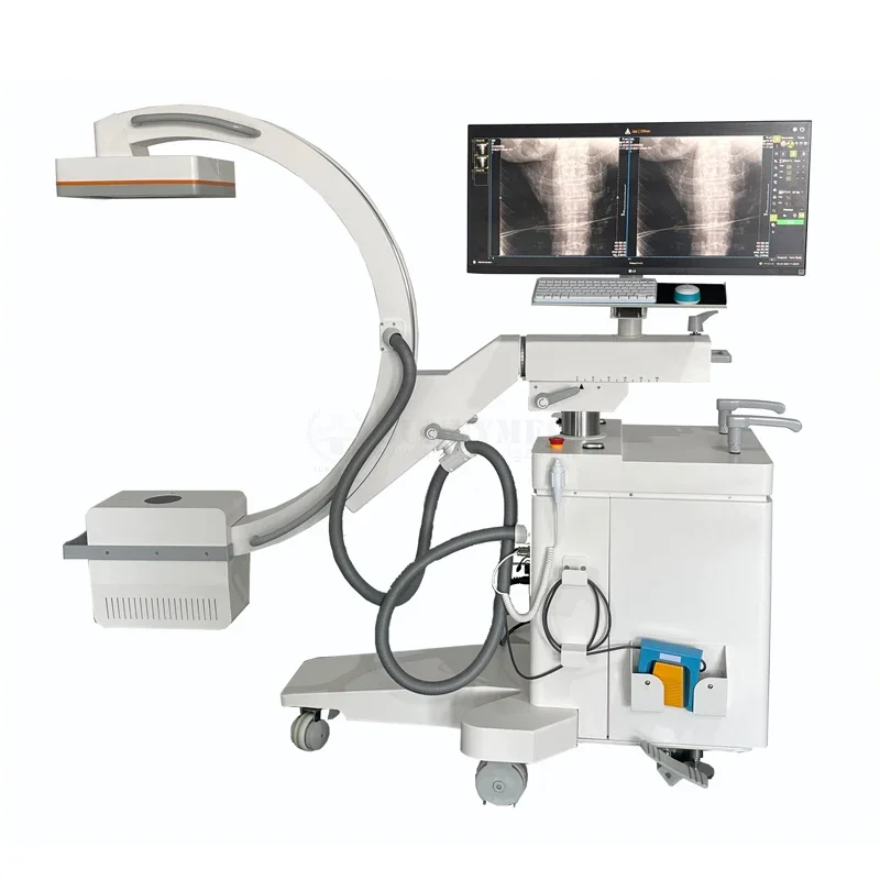 SY-D035E C-arm high-frequency 15kw C-arm mobile digital radiography system x-ray machine