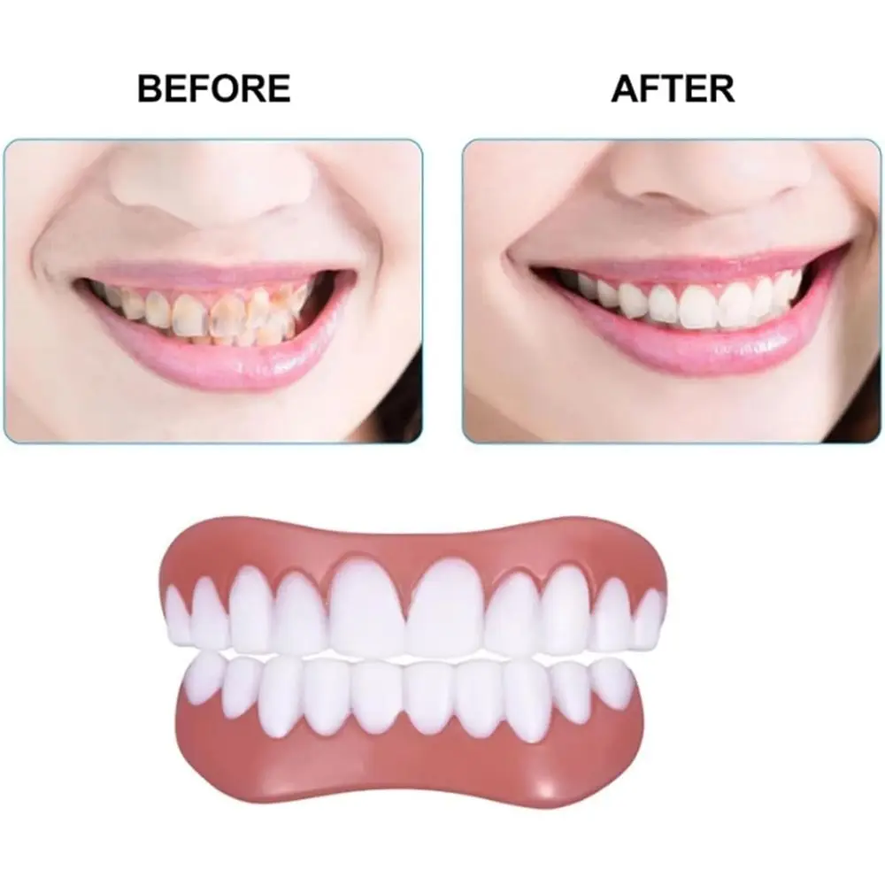 Silicone Denture Reline Kit Comfortable And Firm Soft Denture Silicone Reline Kit Safe And Durable Instant Instant Teeth