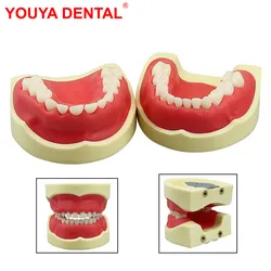 Kids Teeth Model For Dental Technician Practice Dental Typodont Model With Removable Teeth Soft Gums   Dentistry Training Models