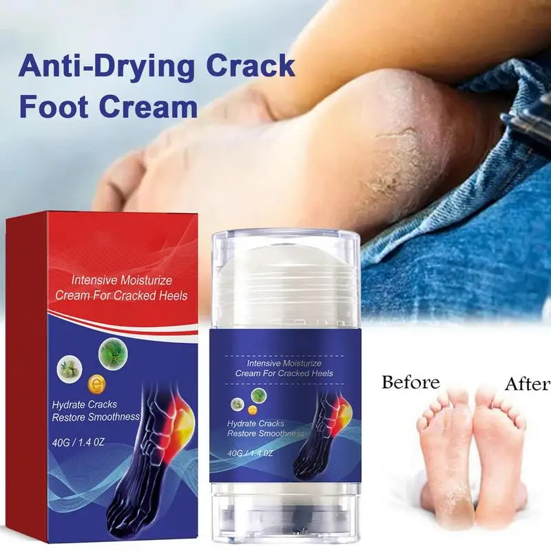 Crack Heel Cracking Repair Products, esfoliação, remoção de pele morta, amolecimento, hidratação, mão, cuidados com os pés, 40g, 1pc