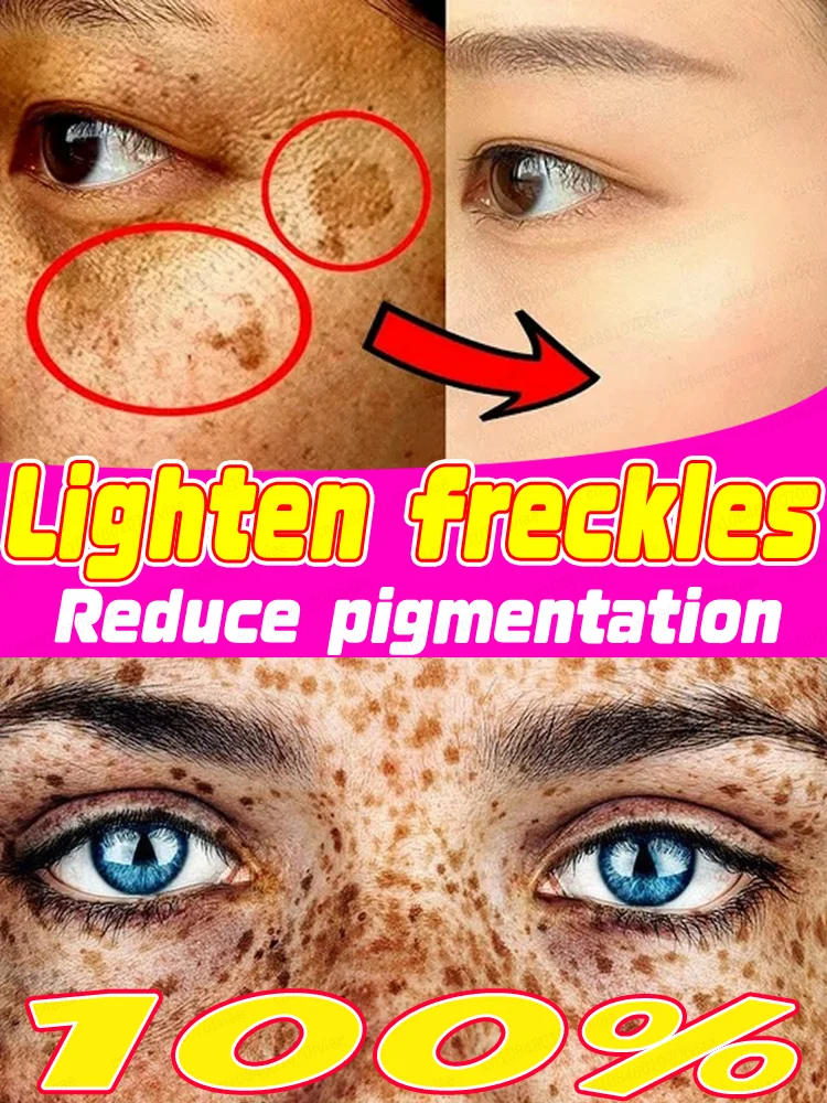 

Iᴍᴘʀᴏᴠᴇ ᴍᴇʟᴀsᴍᴀ Cleanses skin to make it clean and beautiful, reduces pigmentation, and lightens freckles.