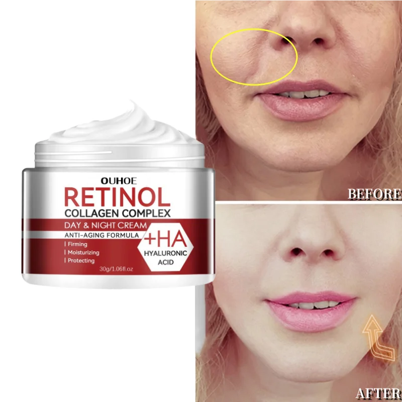 Retinol Wrinkle Removing Cream Anti-Aging Firming Lifting Fade Fine Line Hydronation Moisturizing Brightening Skin Care Cosmetic