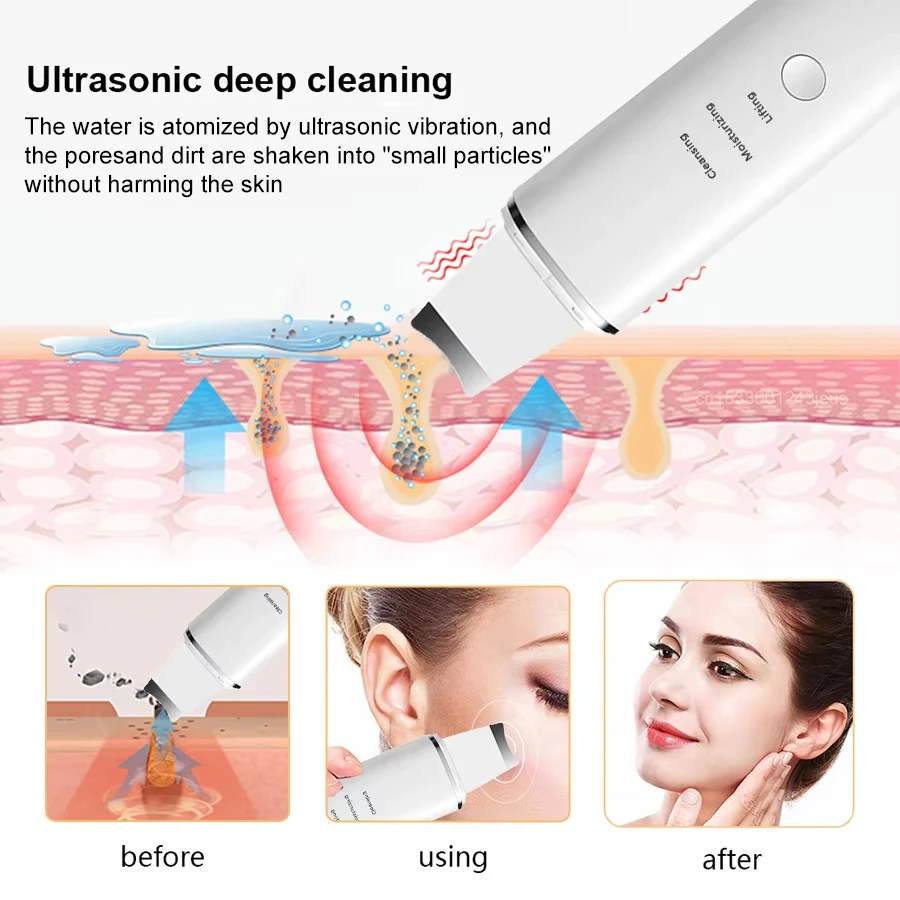 Pulizia profonda del viso, cura della pelle, rimozione dei punti neri sul naso, esfoliazione con un scrub viso elettrico, limpiador faci