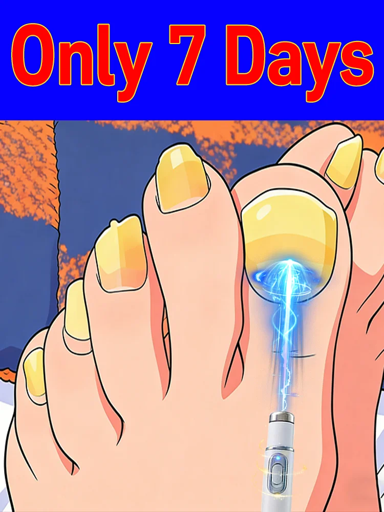 

Quickly restores shine and reduces worries blue light pen ʀᴇᴍᴏᴠᴀʟ ᴡᴀʀᴛꜱ Skin care tools