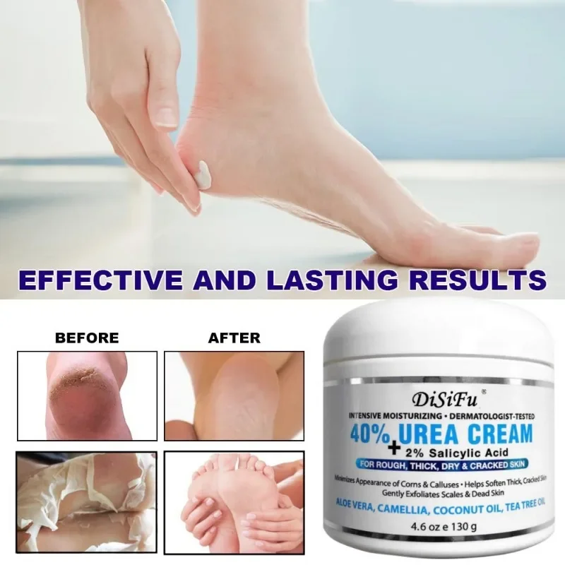 

Urea Cream 40% Plus Salicylic Acid 2%, Foot Cream for Dry Cracked Feet Heels Knees Elbows Hands Repair Treatment,Foot Care