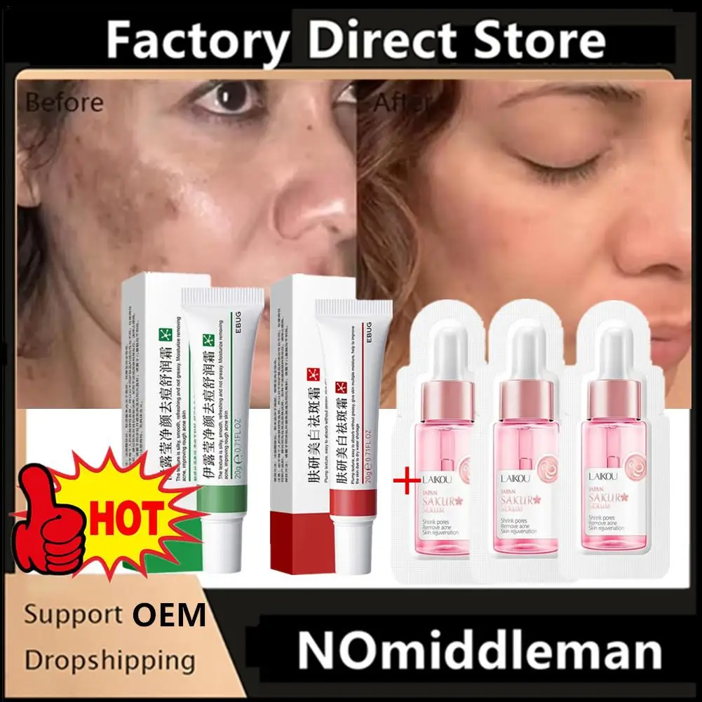 

Powerful Spot-removing Whiten Cream Brighten Skin Fast Eliminates Pigmentation Melasma Dark Spots Moisturize Beauty Gel