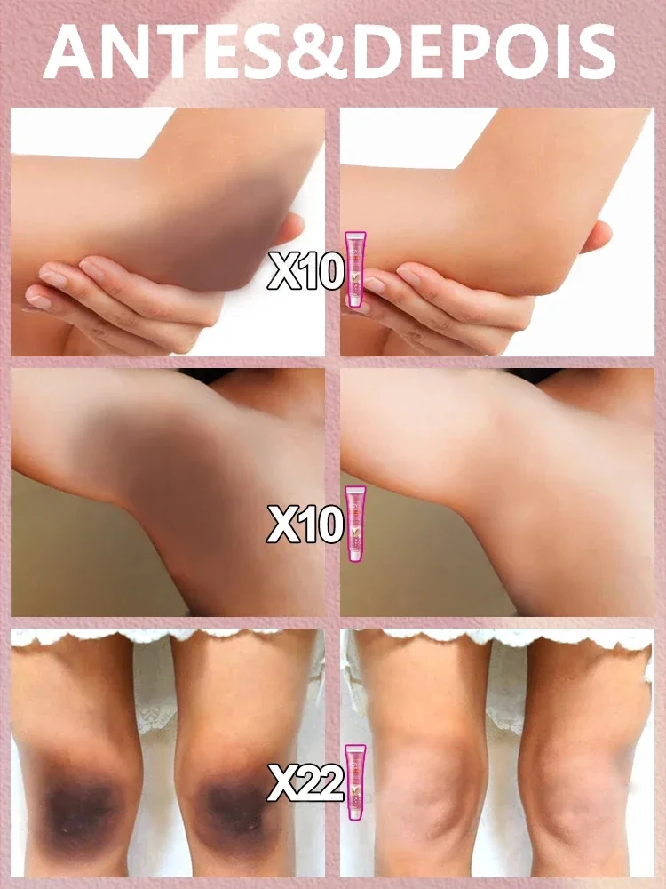 Skin Whitening Cream Private Parts Underarm Bleaching Serum Whiten Butt Knee Brighten Inner Thigh Arm Body Remove Dark Melanin