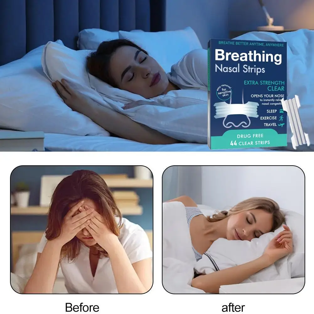 شرائط الأنف التنفس قوة إضافية الرياضة شريط الأنف أفضل النوم غير الغازية مكافحة الشخير شرائط التنفس شرائط الأنف 2026