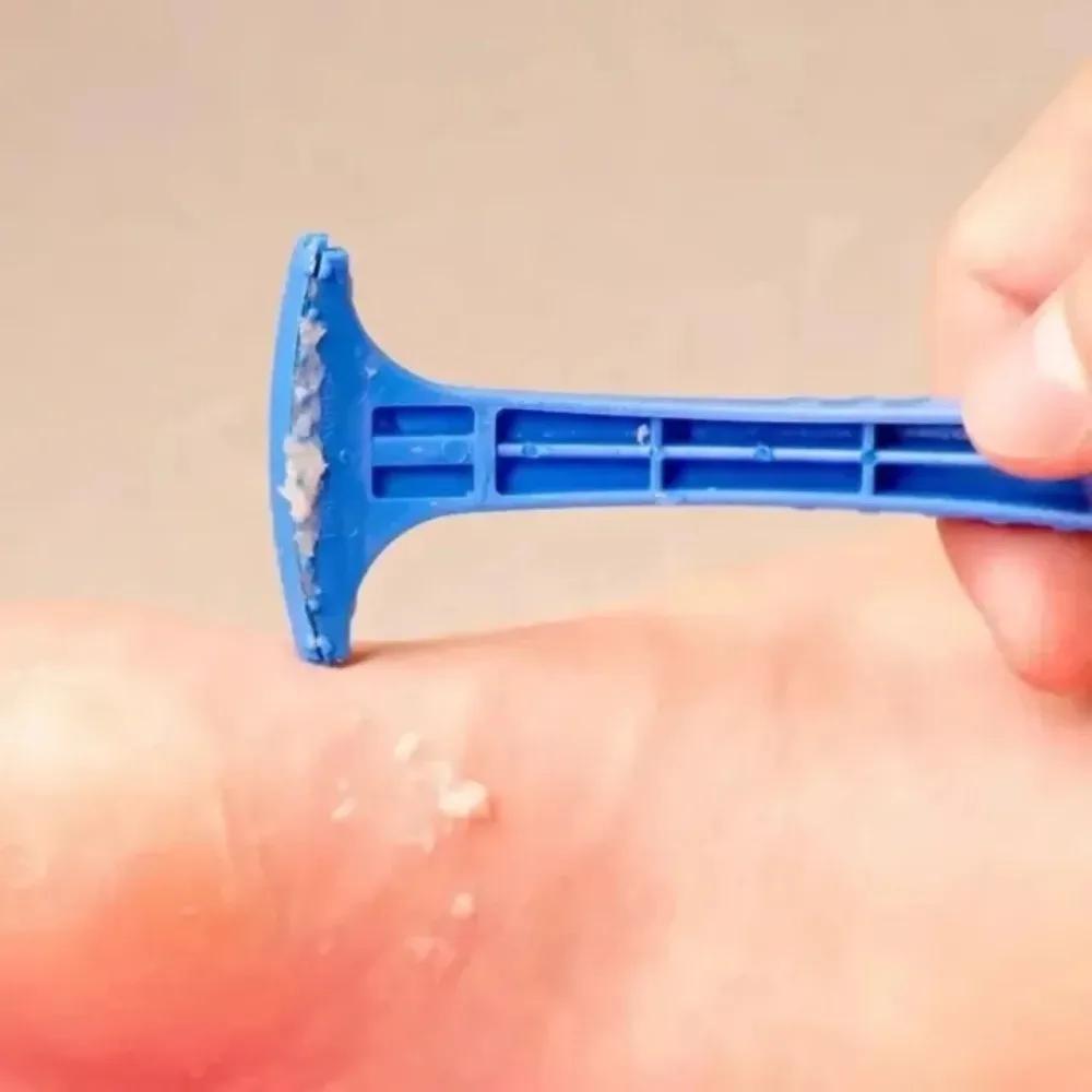 Removedor de Calos de Plástico para Pés, 2 Peças, Ferramenta de Cuidado com a Pele, Raspador Portátil para Pedicure, para Beleza dos Pés em Casa