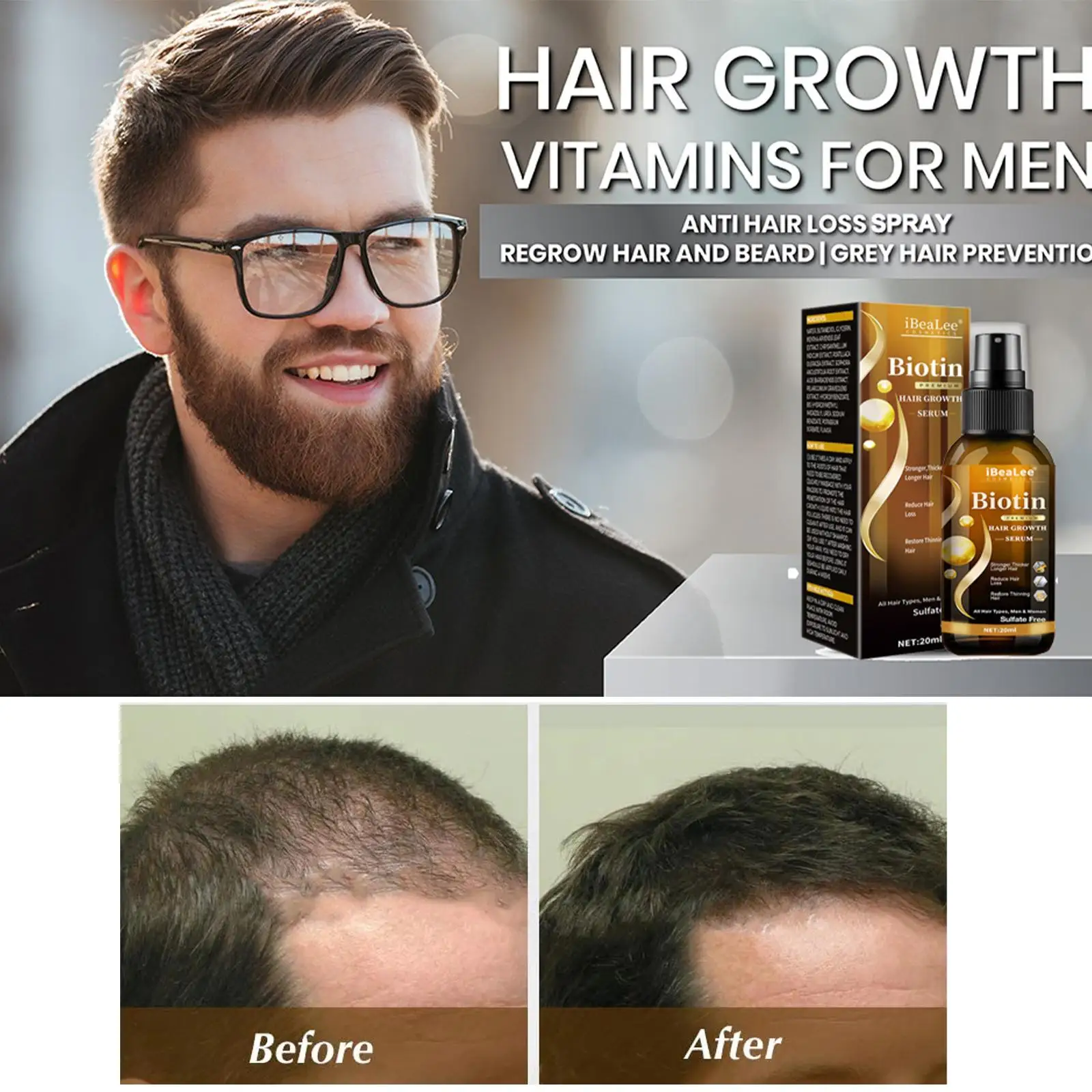 1PCS Anti Hair Loss Serum Fast Spray Products Prevent Baldness Treatment Scalp Dry Damaged Beard Hair Care Oil