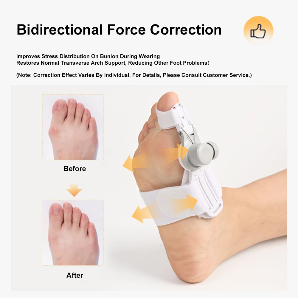 

Adjustable Thumb Valgus Toe Corrector Correct Thumb Deformity Big Foot Bone Toe Separator Knob Bunion Corrector Foot Care Tool