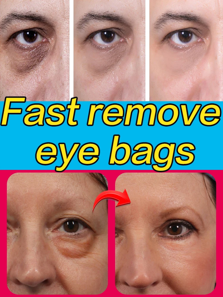 

Eye Cream Dark Circles And Bags