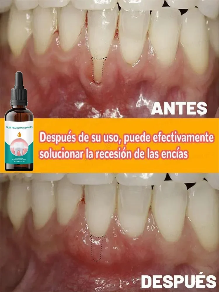 Repair gums, no more worries