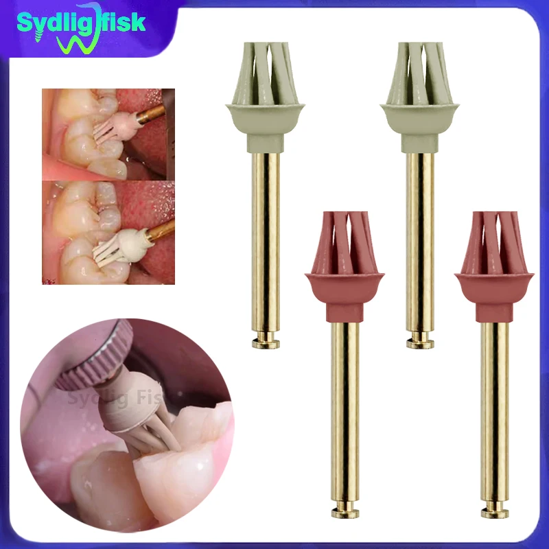 

Dental Rubber Polisher 2-Step Diamond Impregnated Polishers of Occlusion Composite Resin Spiral Flex Wheel Brush Dentist Tools