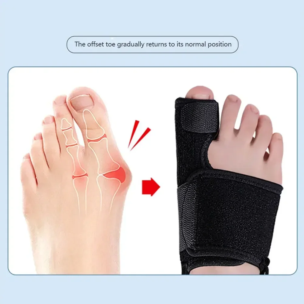 발가락 교정기 정형외과 뼈 엄지 조절기 해머 보호대 소프트 페디큐어 양말 발가락 교정기 발 관리 도구 1Pcs