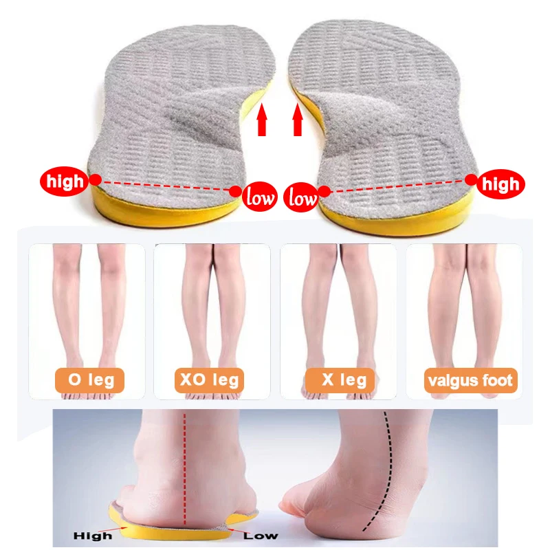 

O/X-leg flat foot Orthopedic insoles unisex inside outside the eight-character O-shaped leg correction valgufoot full sports pad