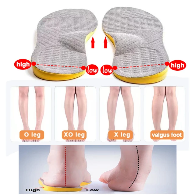 O X leg flat foot Orthopedic insoles unisex inside outside the eight character O shaped leg correction valgufoot full sports pad AliExpress