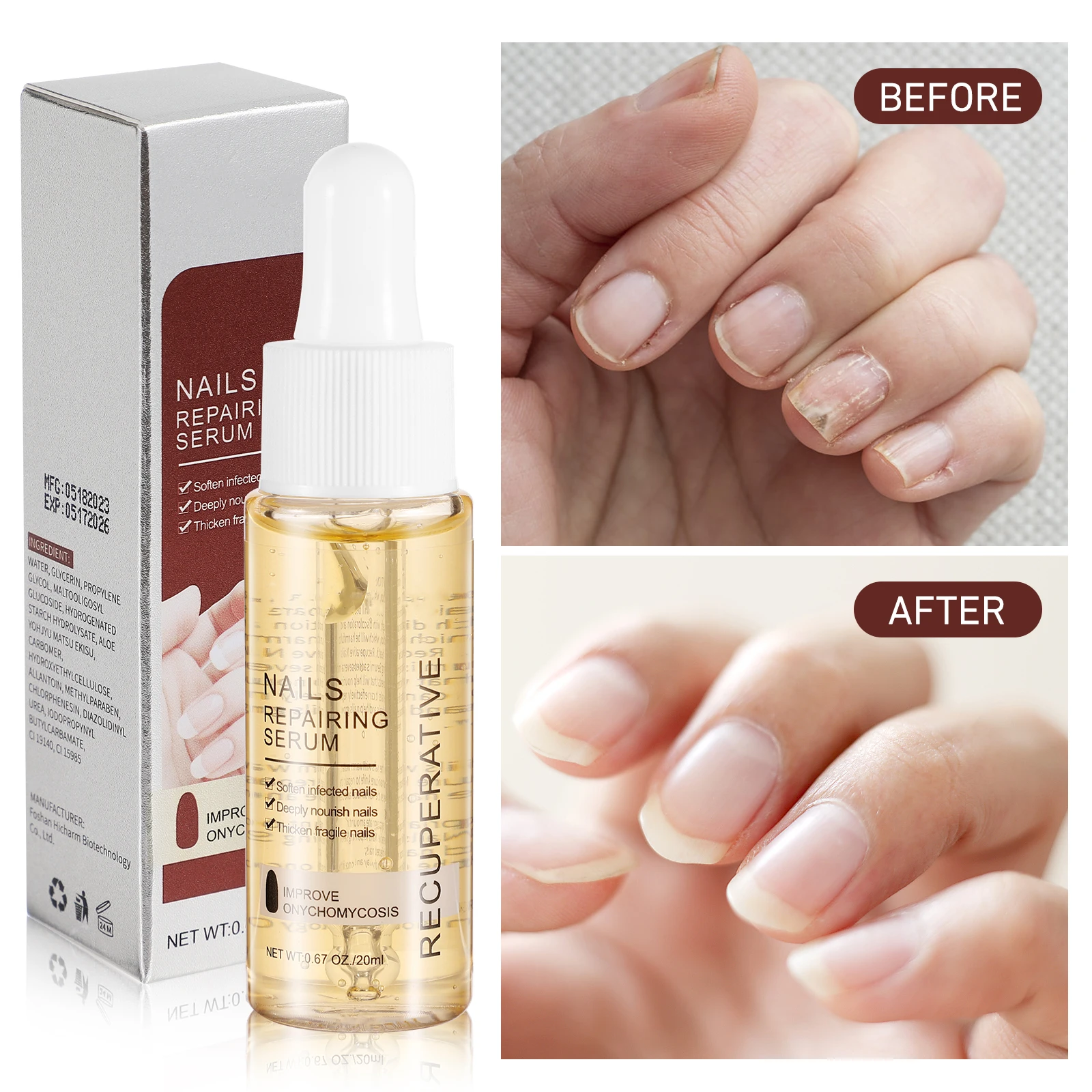 1pc 爪真菌症修復ソリューション爪強化柔軟剤キューティクルオイルペン血清保湿健康な爪治療液