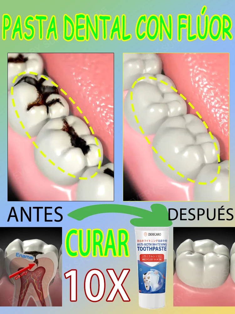 Decaimiento dental