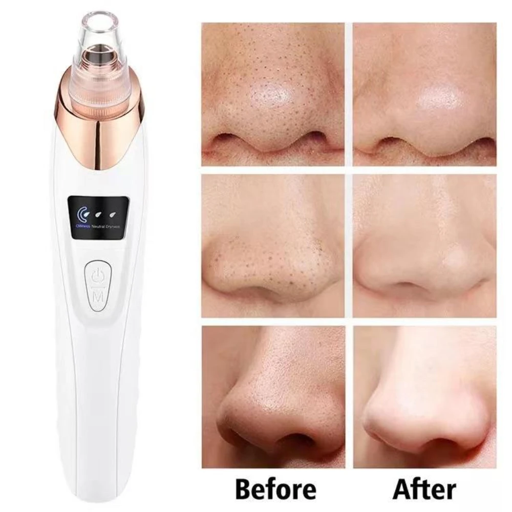 Electric Blackhead Remover Vacuum Acne Cleaner Black Spots Removal Facial Deep Cleansing Pore Cleaner Machine Skin Care Tools