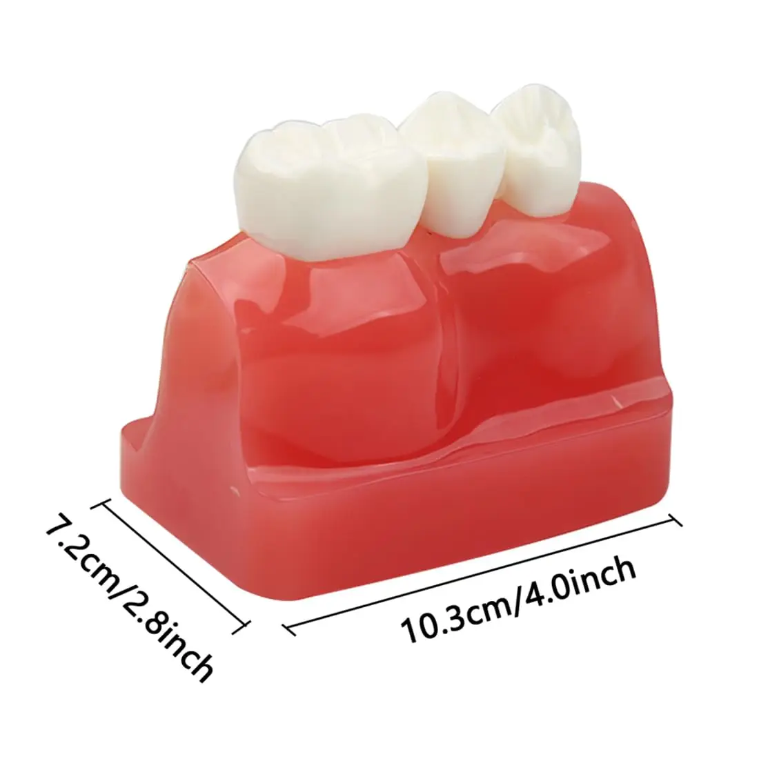 Image 5: Modèle d'implant dentaire AG, pont de couronne amovible, modèle de démonstration de dents 4 fois pour l'enseignement, l'éducation des patients