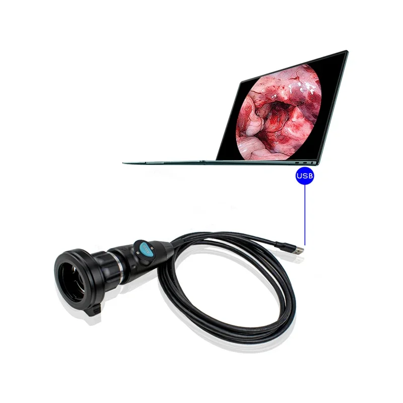 

1080P HD Portable Medical Endoscopic for ENT Rigid Nasal Endoscopy