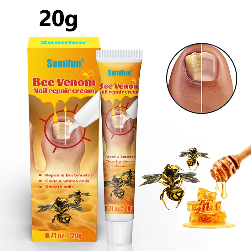 20g Krim Perawatan Kuku Krim Perawatan Kuku Racun Lebah Salep Ulser Tekanan Racun Lebah
