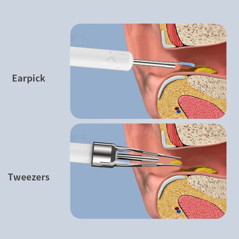Dodosee 2300P HD Visual Ear Cleaner con fotocamera Strumento per la rimozione del cerume con pinzette Otoscopio Ear Pick Rimuovi lo sporco dell'orecchio Assistenza sanitaria