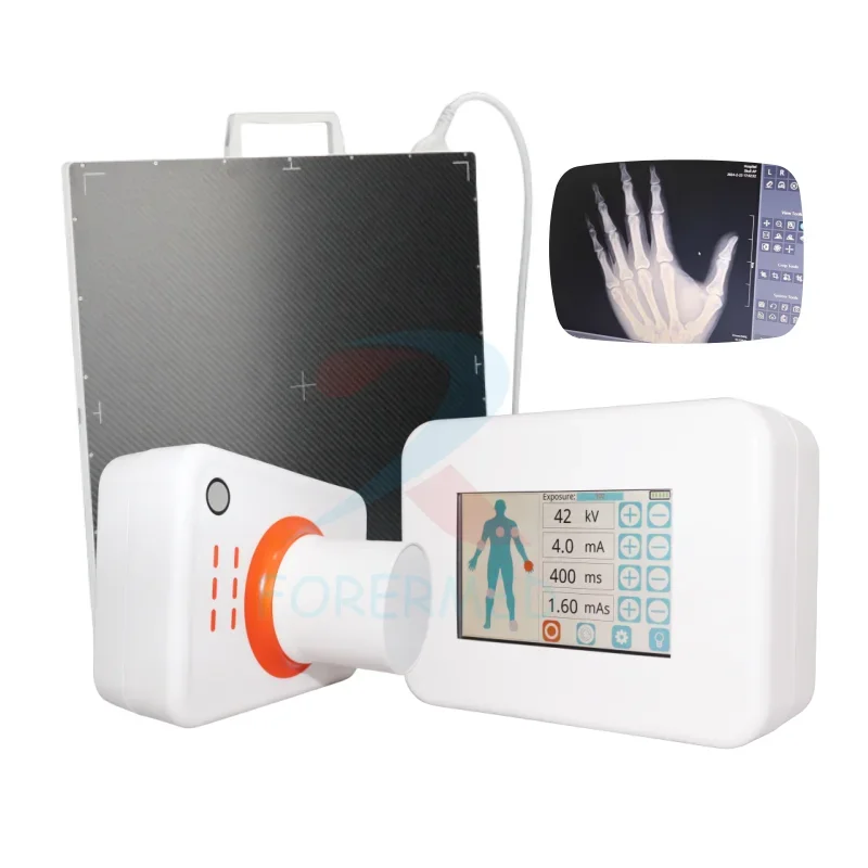 1.6KG Ultralight Hand held X Ray Machine Portable Digital Xray Machine Color Touch Screen 360W Human X-Ray