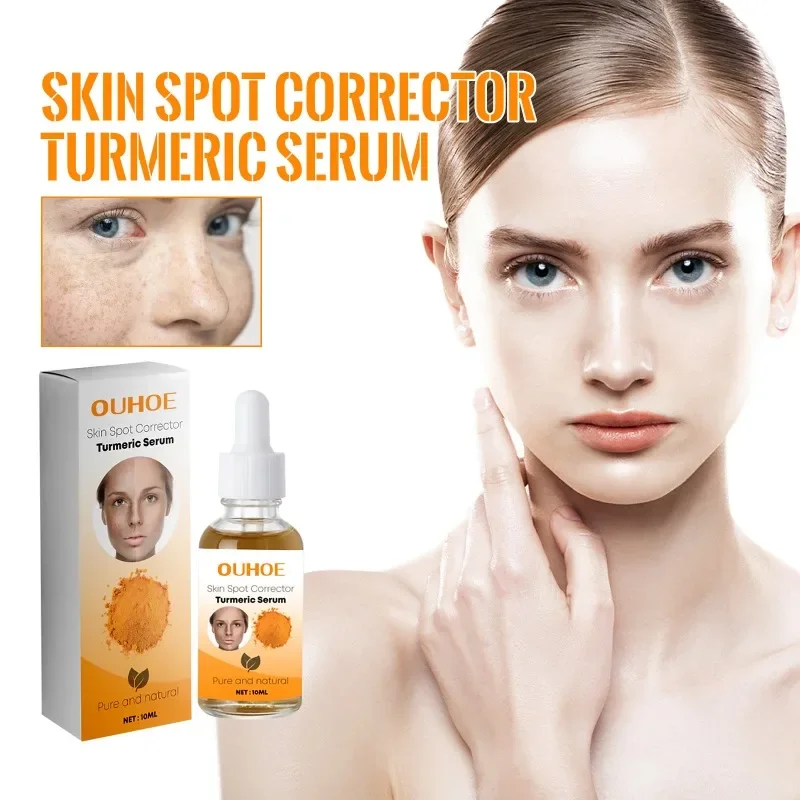 

Turmeric Melasma Whitening Correcting Serum Facial Care Essence Oil Dark Spot Removal Brighten Skin Fade Pigment Freckle Melanin